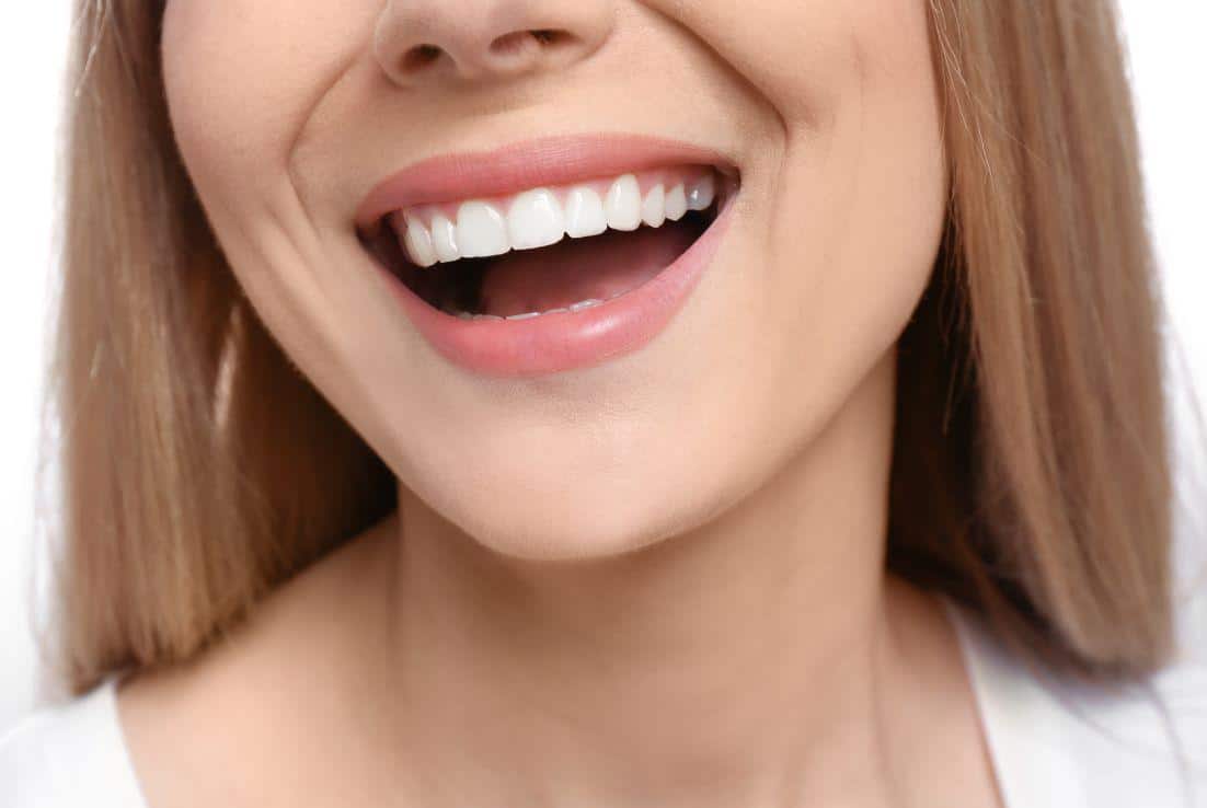 Benefits of Having Straight Teeth