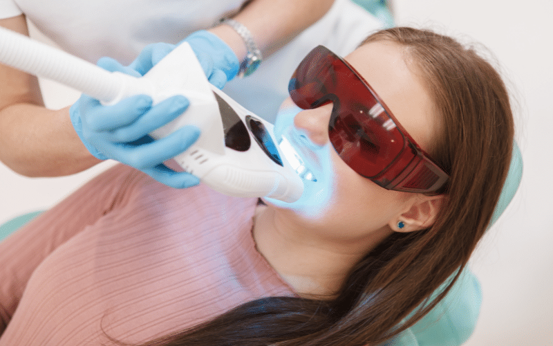 Professional Teeth Whitening A Step-By-Step Process