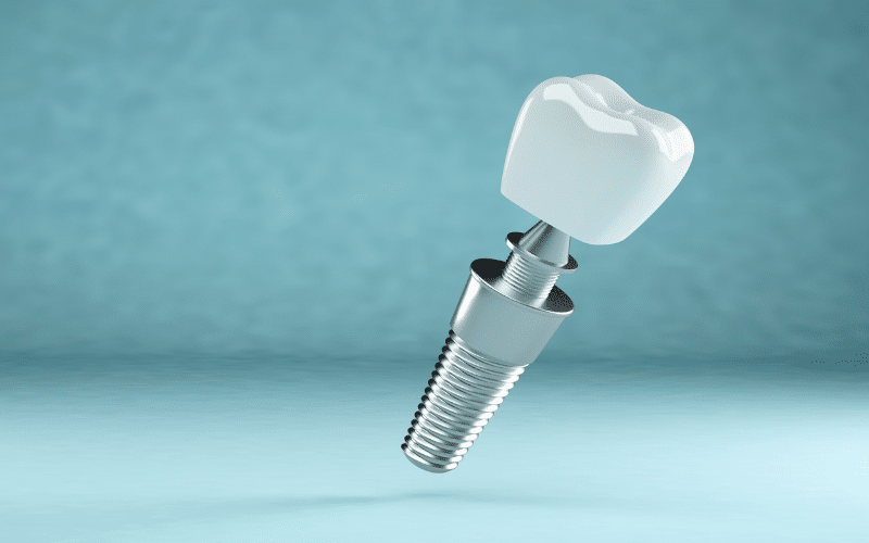 the risks and side effects of dental implants