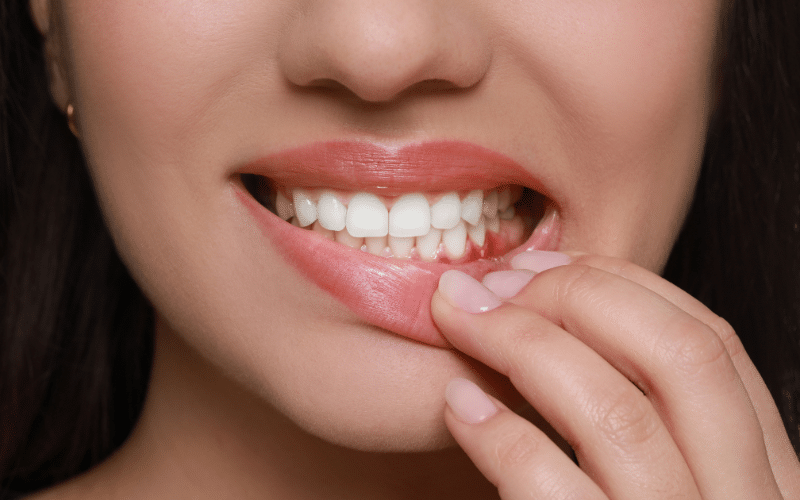Avoid Gum Disease with Periodontal Therapy