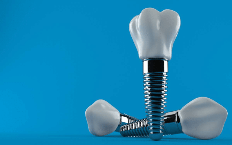 Right Candidate For Dental Implants