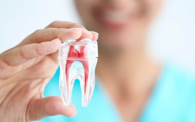 How Root Canal Therapy Removes Infection In Tooth Nerves