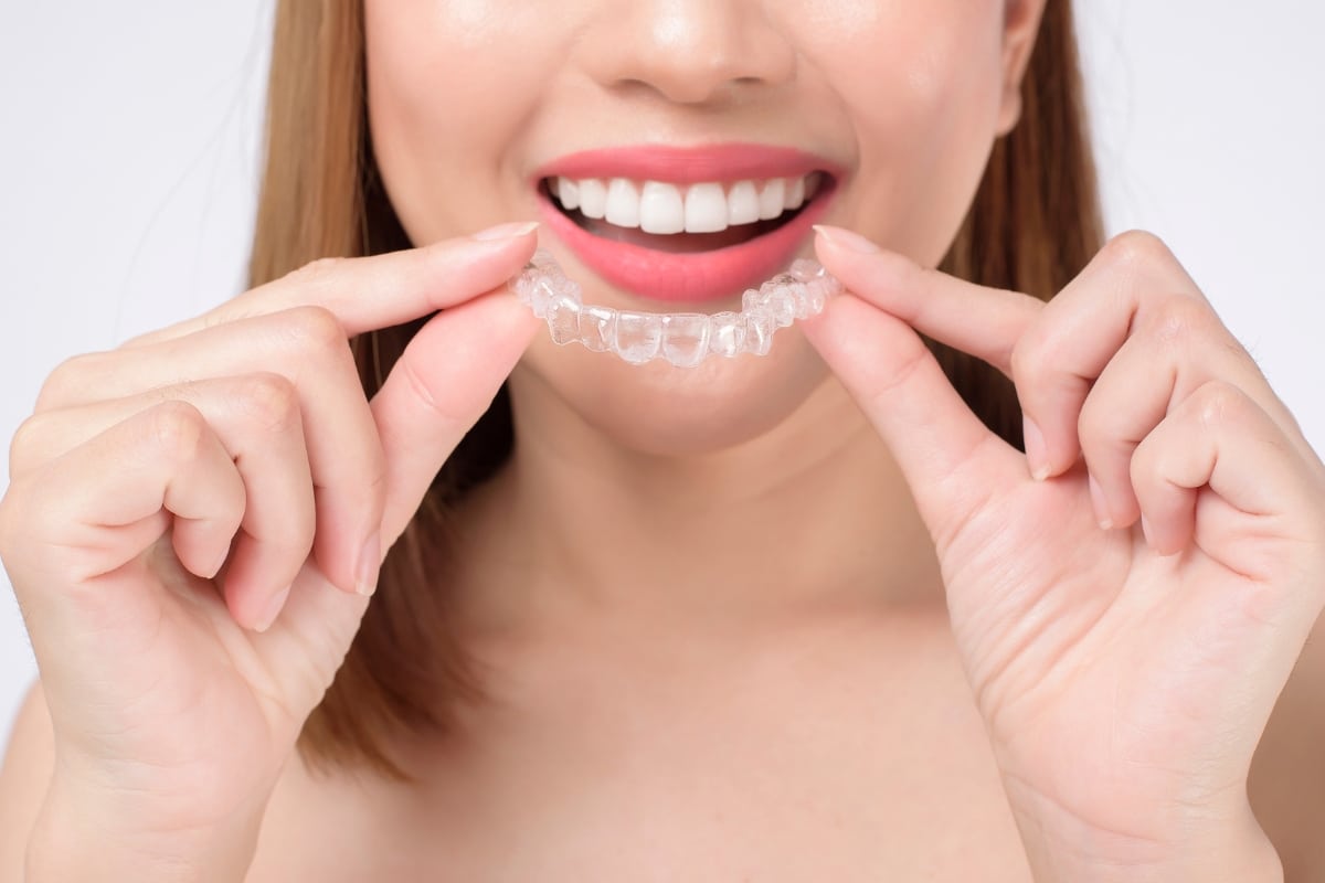 Featured image for “Fixing a Crossbite: Functional and Aesthetic Correction with Invisalign in Yorkville, IL”
